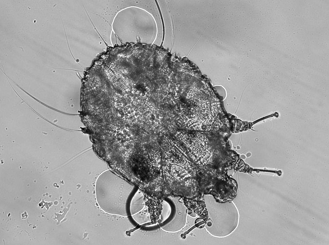 Scabies mite under a microscope <br />Image credit: Arthur Goldstein, 2018</br>“><br /><em>A doctor may prescribe scabicides to treat people with scabies. <br />Image credit: Arthur Goldstein, 2018</em></div><p>It is important to seek prompt treatment for scabies, especially for people with a weakened immune system. Delaying treatment increases the risk of developing secondary infections and passing the mites on to other people.</p><div style=